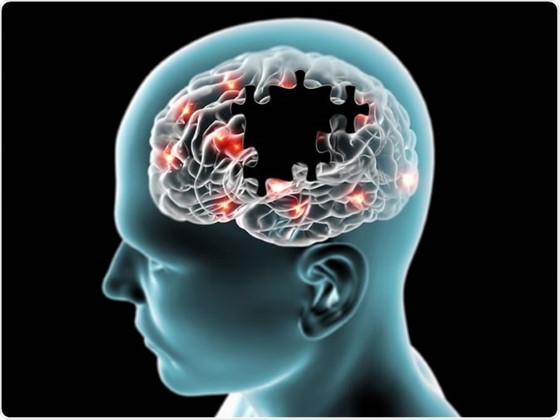 Velké množství studií a rozsáhlých výzkumů, potvrzuje potenciálně vysokou účinnost CBD při léčbě různých typu neurodegenerativních onemocnění; zdroj: news-medical.net